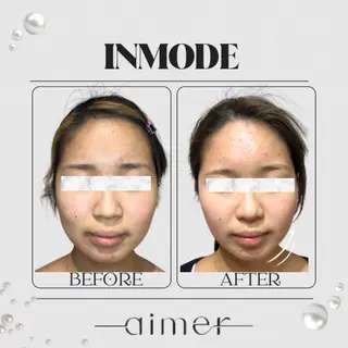 aimer服部 /  小顔 ・ 痩身のその他イメージ