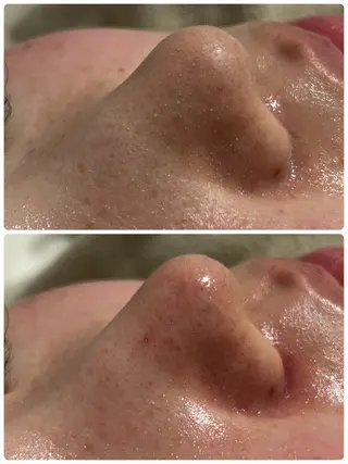 フェイシャルサロン CHIARA　美月のエステ・リラクイメージ