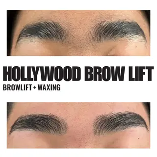 小顔矯/美容鍼/鍼灸 BeauJuのその他イメージ