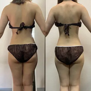 ハイパーナイフ専門店　Salon de COCO所属・Salon de COCOのエステ・リラクイメージ