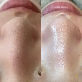 New __のその他イメージ