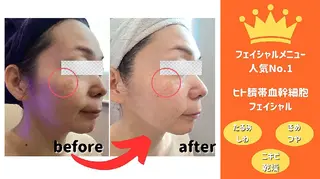 Hisui 種村のエステ・リラクイメージ