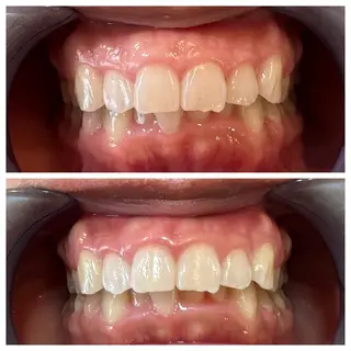 セルフホワイトニング Shineeのエステ・リラクイメージ