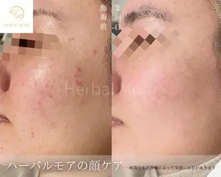 脱毛・眉毛・フェイス サロンN久留米店の眉毛・アイブロウイメージ