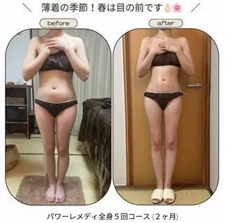 《本気痩せ×疲労改善 》  BILOOPのエステ・リラクイメージ