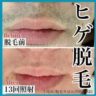 メンズ TSUBAKI上尾店所属・TSUBAKI上尾店 松下のエステ・リラクイメージ