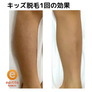 キッズ エピット横浜磯子店 大森のエステ・リラクイメージ