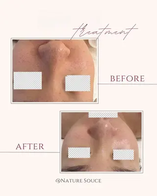 Nature Souce毛穴専門店のその他イメージ