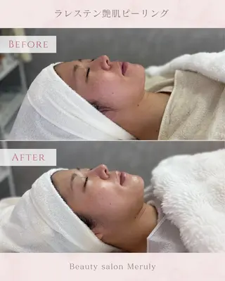 Meruly所属・Meruly ♡のエステ・リラクイメージ