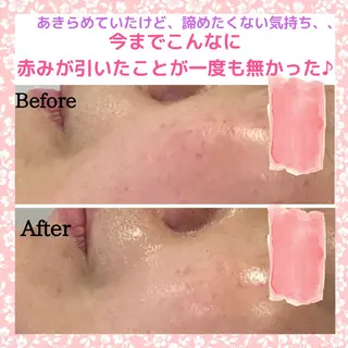 三沢市エステサロン Sブランペタルのエステ・リラクイメージ