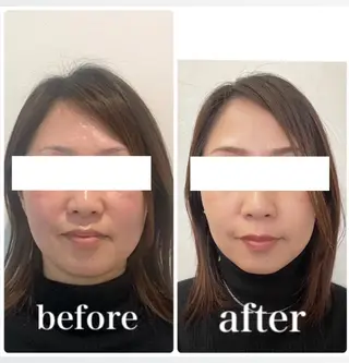 小顔と ヘッドスパのお店のエステ・リラクイメージ