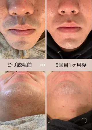 メンズ 脱毛サロン Arumのエステ・リラクイメージ
