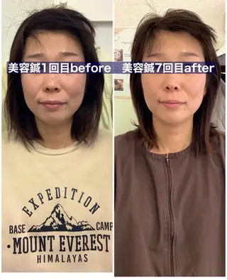 美容鍼灸×小顔整体♡ ハリサロンドオフ堺東のその他イメージ