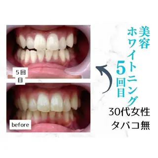 ホワイトニングサロン le  canonのその他イメージ