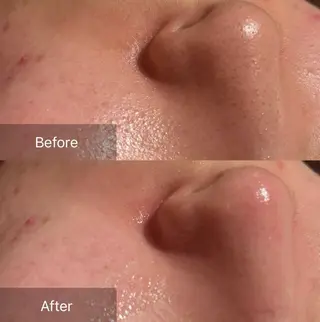 for woman所属・森 美優のエステ・リラクイメージ