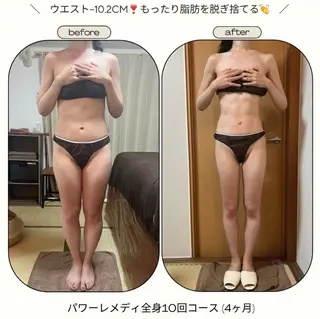 《本気痩せ×疲労改善 》  BILOOPのエステ・リラクイメージ