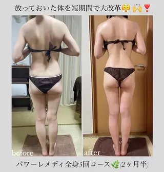 《本気痩せ×疲労改善 》  BILOOPのエステ・リラクイメージ