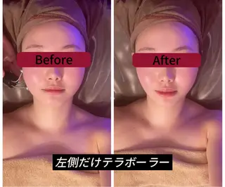 アンベリーノ Yuuriのエステ・リラクイメージ