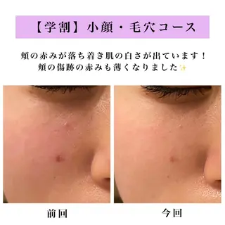 Bellesthe (ベルエステ)のエステ・リラクイメージ