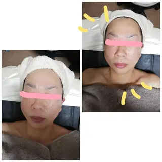 Alphaplus AYAMI のエステ・リラクイメージ