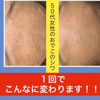 ロング カラー パーマ ヘアアレンジ メンズ キッズ ネイル マツエク・マツパ ニキビ・肌質改善専門 ♡人生が変わるサロンのエステ・リラクイメージ