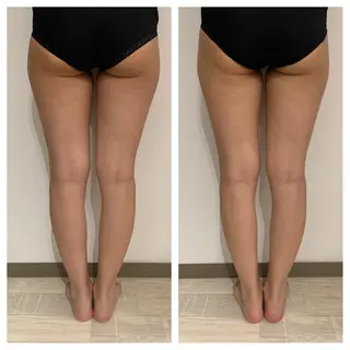 リンパマッサージ mimozaのエステ・リラクイメージ