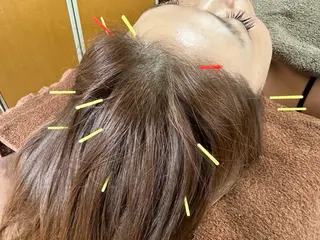 美容鍼・脱毛サロン CURAIMのエステ・リラクイメージ