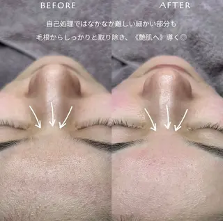 フェイシャルワックス KANAKOのエステ・リラクイメージ