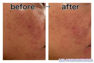 美肌育成サロン LEA武蔵小杉のエステ・リラクイメージ