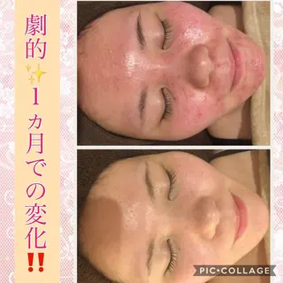 ミディアム カラー パーマ ヘアアレンジ メンズ キッズ ネイル マツエク・マツパ ニキビ・肌質改善専門 ♡人生が変わるサロンのエステ・リラクイメージ