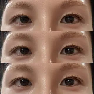 マツエク・マツパ まつ毛の悩み解消 Dacha吉岡の眉毛・アイブロウイメージ