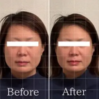 Lily luce 美骨小顔矯正のその他イメージ