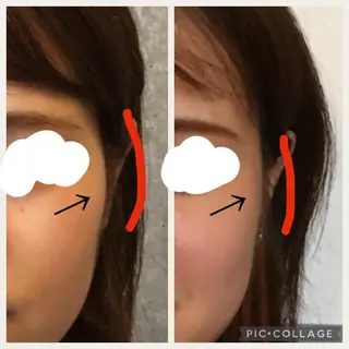 natural 小顔・美容矯正〽️のエステ・リラクイメージ