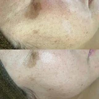 BeautySalo nCielChibaのエステ・リラクイメージ