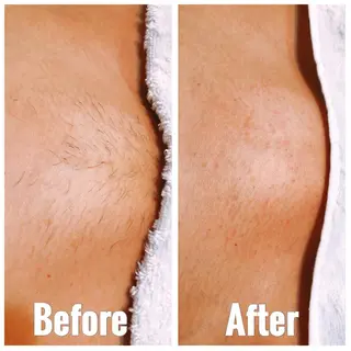 B.GLAM シュガーリング渋谷のエステ・リラクイメージ