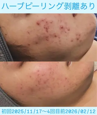 Soin所属・Soin 身体＆お肌ケアのエステ・リラクイメージ