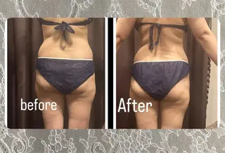 浮腫|肩こり|張り 日々の疲れを解消★のエステ・リラクイメージ