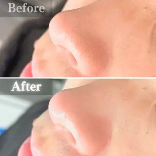 毛穴洗浄特化🫧 オオツカのエステ・リラクイメージ