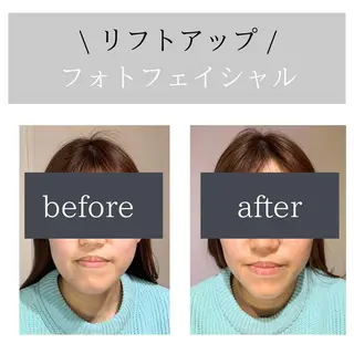 脱毛サロン Lokahiのエステ・リラクイメージ
