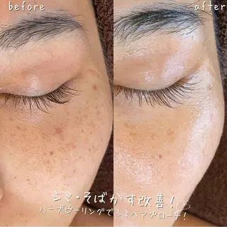 NA skin たまプラーザ　川島のエステ・リラクイメージ