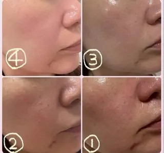 Novelle所属・nozomi.m🌷 narisのエステ・リラクイメージ