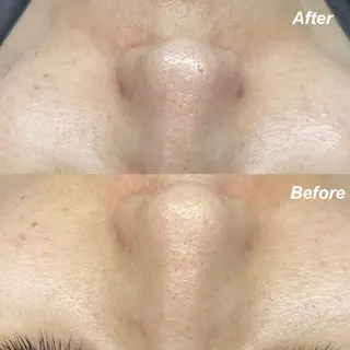 🌿hitomi🌿 艶肌/肌質改善のエステ・リラクイメージ