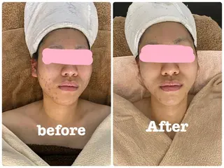 メナードフェイシャルサロン大曽根店所属・濱野 ゆうかのエステ・リラクイメージ