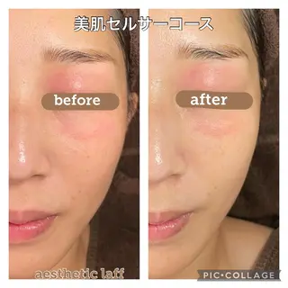 美肌作りのサロン 山村亜美のエステ・リラクイメージ