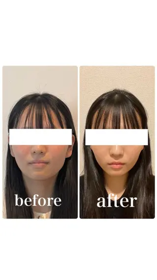 小顔と ヘッドスパのお店のエステ・リラクイメージ