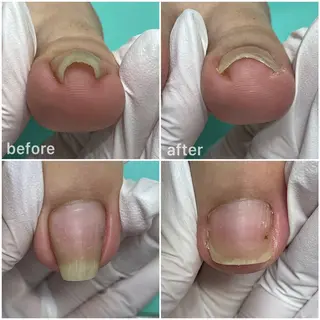 東京巻き爪アカデミー所属・東京巻き爪 アカデミーのエステ・リラクイメージ