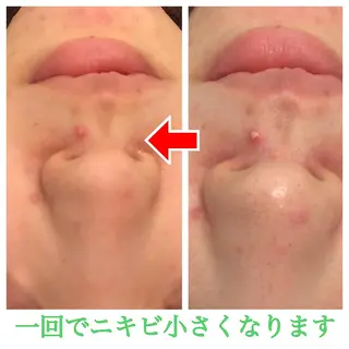 ミディアム カラー パーマ ヘアアレンジ メンズ キッズ ネイル マツエク・マツパ 金の糸脱毛 産毛ケア専門のエステ・リラクイメージ
