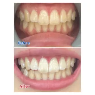 M渋谷 ホワイトニングのエステ・リラクイメージ