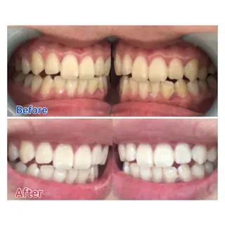 M渋谷店所属・M渋谷 ホワイトニングのエステ・リラクイメージ