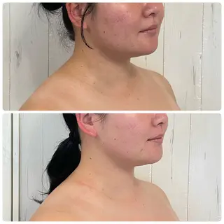 小顔・たるみケア✨ フェイシャル&ボディのエステ・リラクイメージ